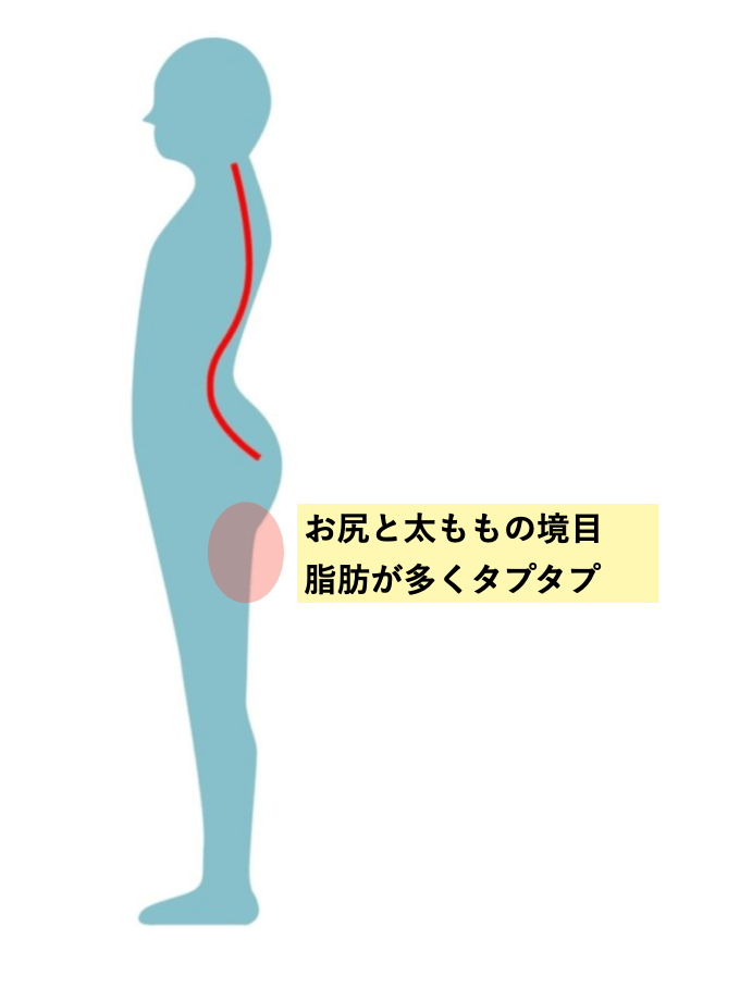 反り腰の特徴とは 反り腰が原因で起こる6つの下半身太り テツログ ダイエット完全攻略