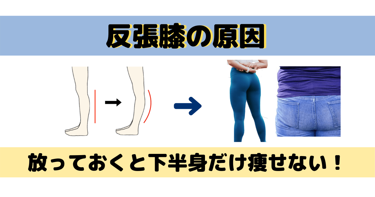 反張膝の原因 放っておくと下半身だけ痩せない テツログ ダイエット完全攻略