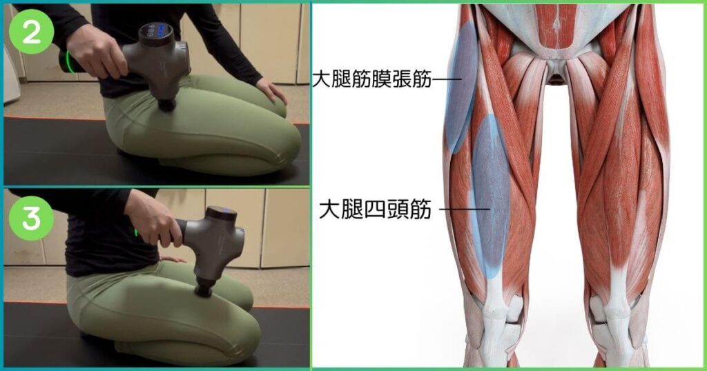 ボディピクセルPROの使い方 大腿筋膜張筋 大腿四頭筋