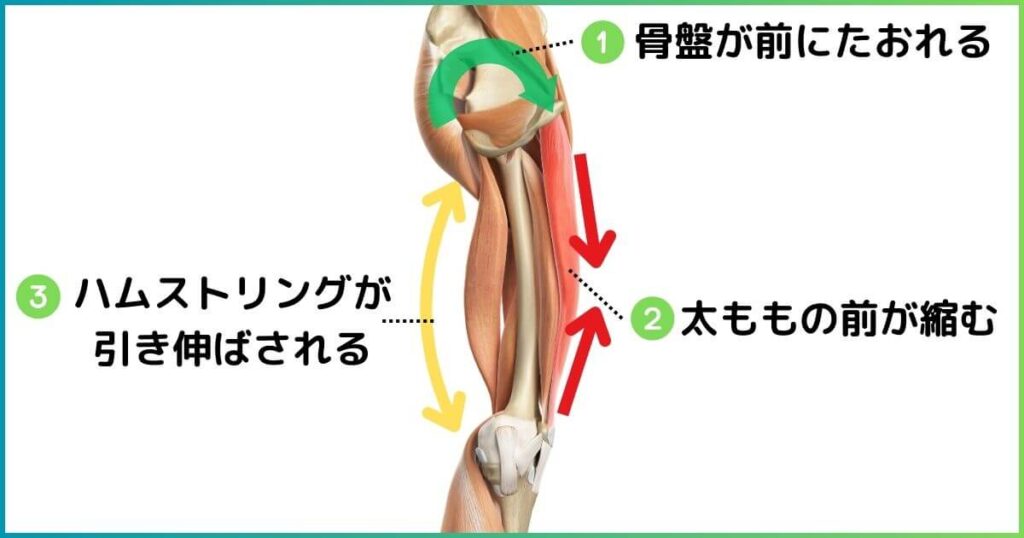 ハムストリングと反り腰の関係