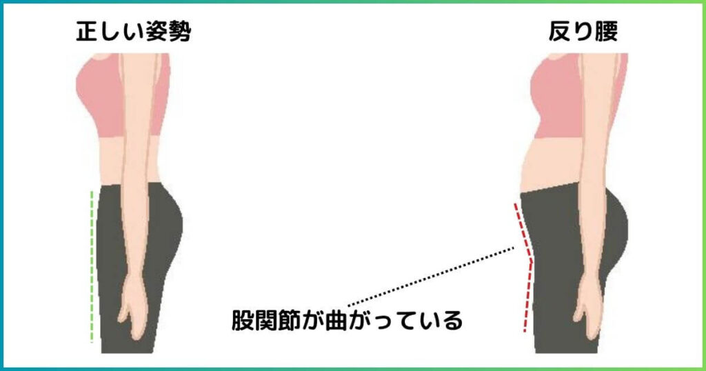 反り腰によって股関節が屈曲している