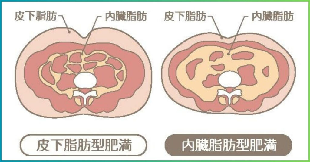 皮下脂肪と内臓脂肪
