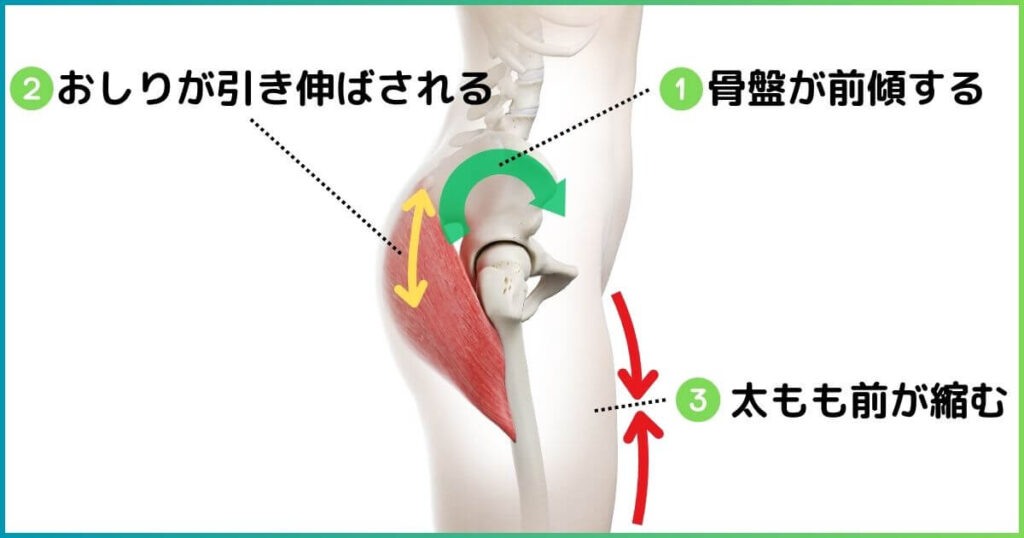 反り腰　大臀筋が受ける影響