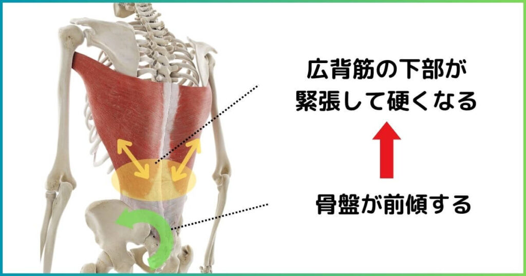 広背筋と反り腰の関係