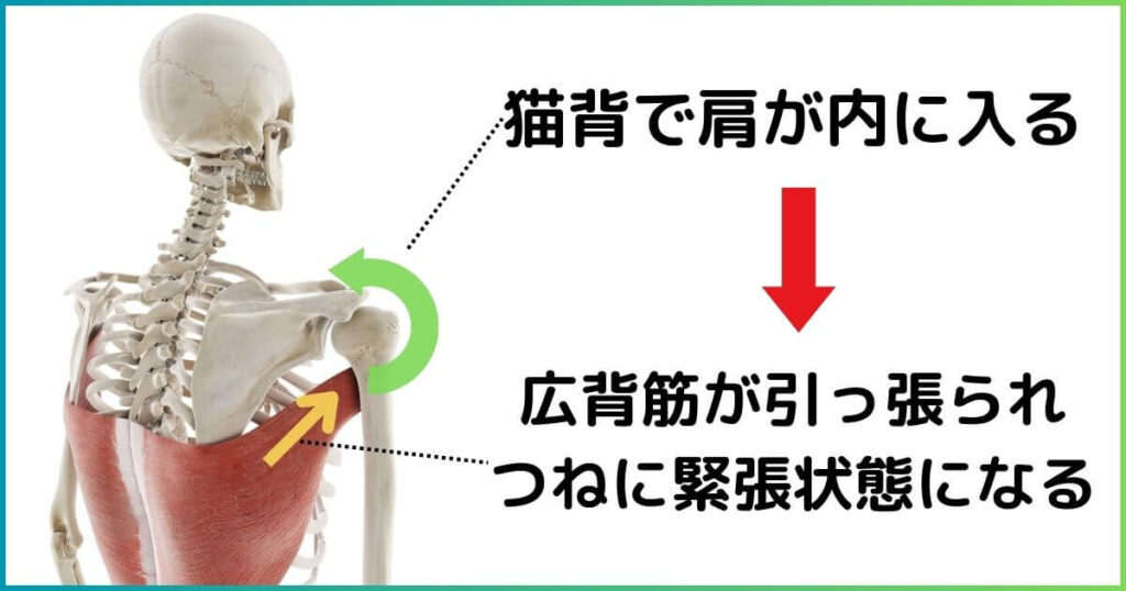 広背筋と猫背の関係