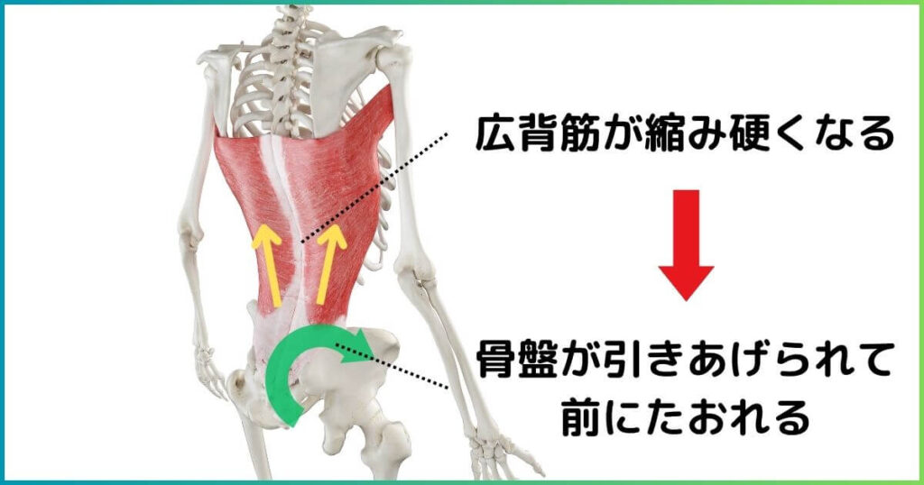 広背筋と骨盤前傾の関係