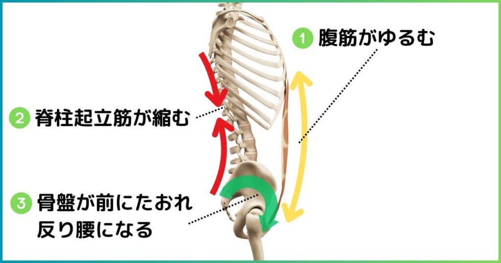 腹筋が弱いと脊柱起立筋が緊張し反り腰になる