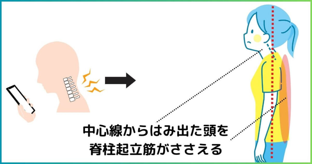 スマホ首と脊柱起立筋の関係