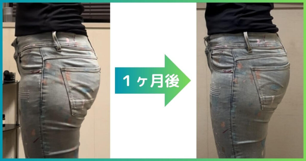 反り腰改善 ヒップアップ ビフォーアフター