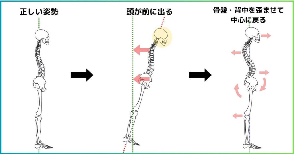 重心が前に移動すると反り腰になる