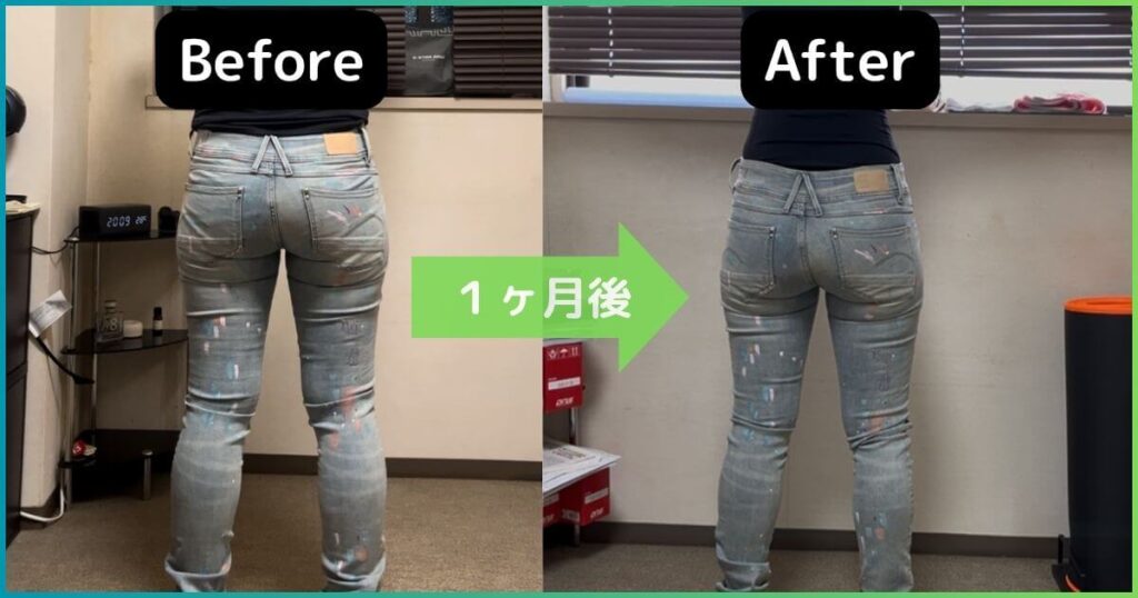 反り腰改善のビフォーアフター