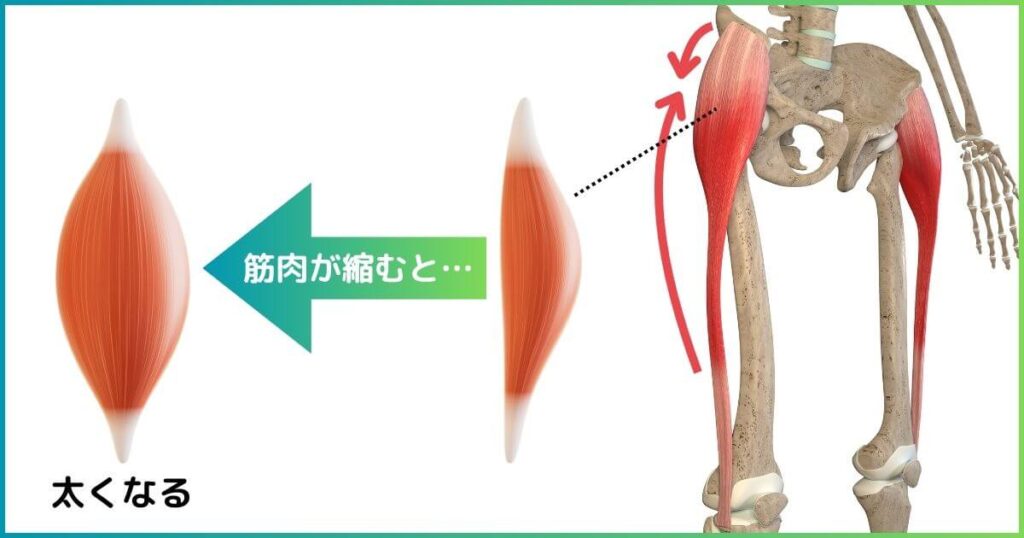 大腿筋膜張筋が縮むと太くなる