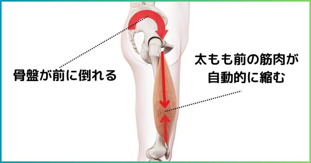 反り腰と大腿四頭筋の関係