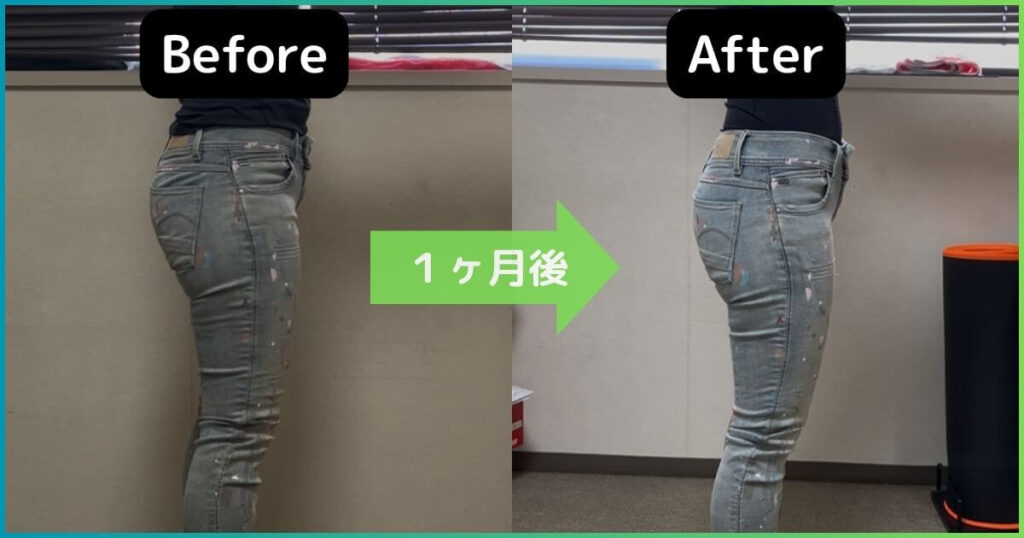 反り腰改善のビフォーアフター