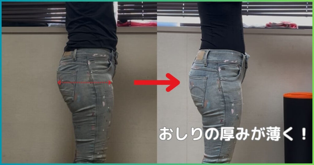 反り腰改善のビフォーアフター