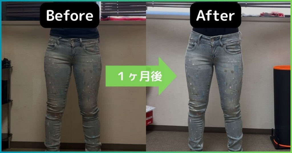 反り腰改善のビフォーアフター