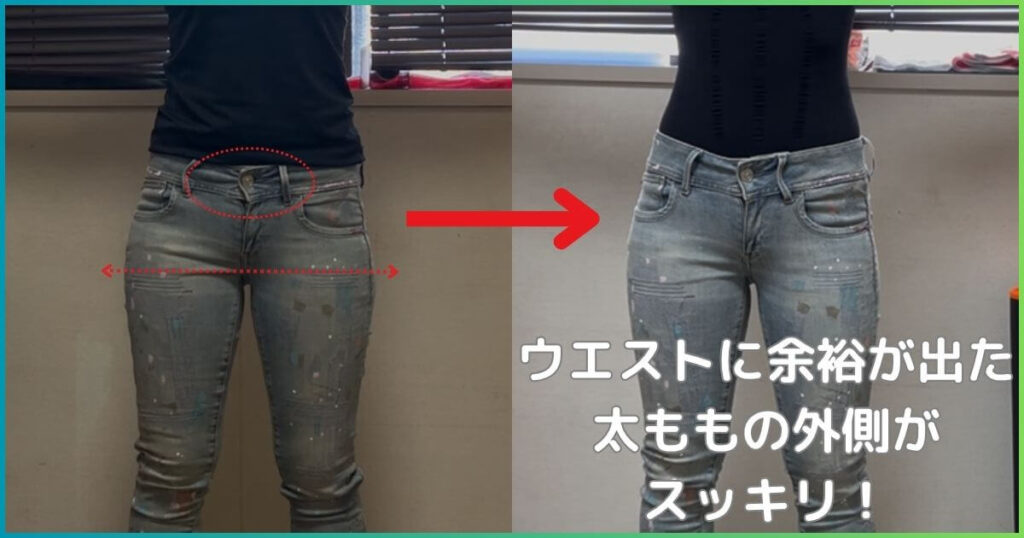 反り腰改善のビフォーアフター