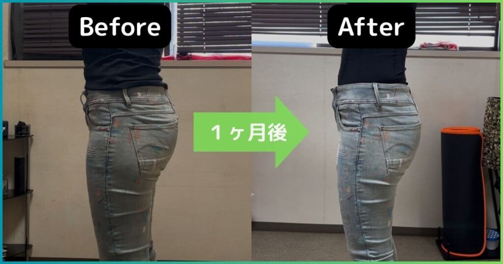 反り腰改善のビフォーアフター